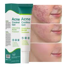 Acne Control Gel