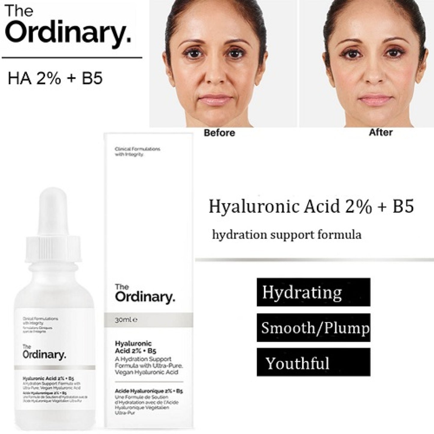 The Ordinary Hyaluronic Acid 2% + B5 30ml
