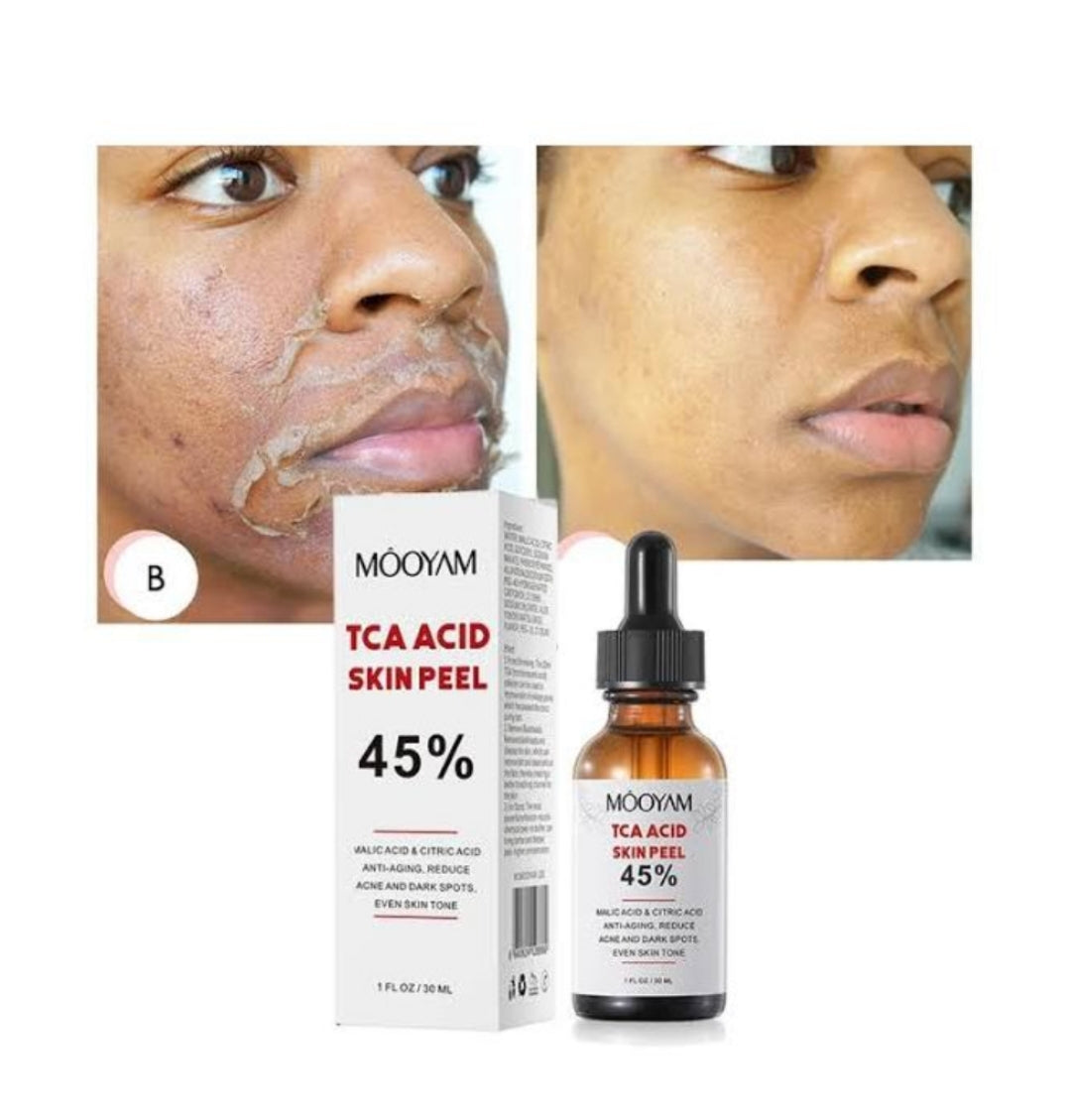 Mooyam TCA Peel 45%