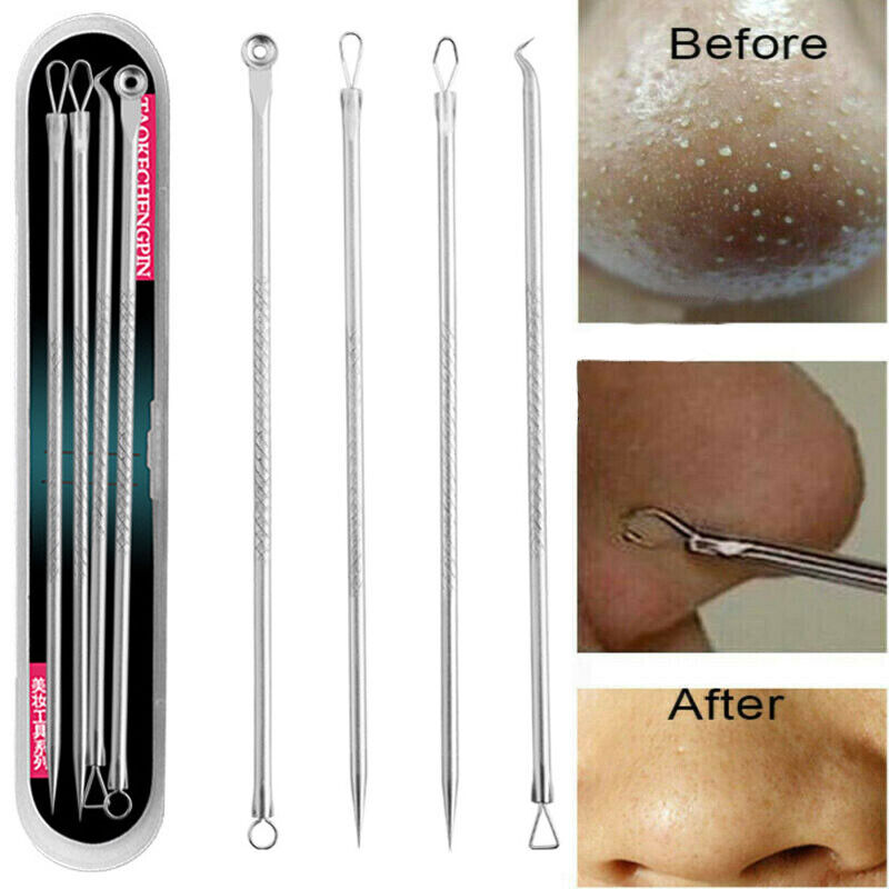 Blackhead Extractor Toolkit