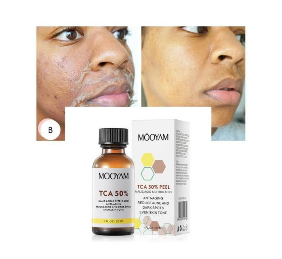 Mooyam TCA Peel 50%